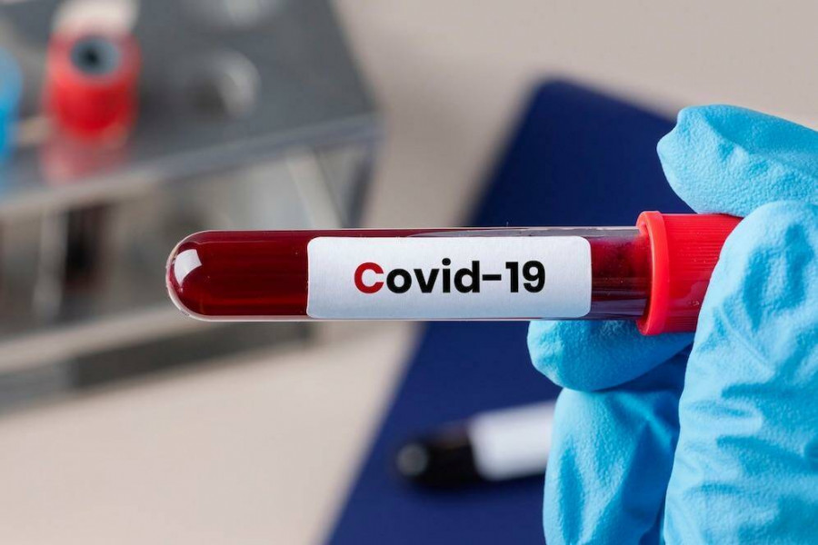 Где в Самарской области 15 февраля выявлены новые случаи коронавируса
