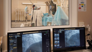 В Клиниках СамГМУ впервые в регионе начали выполнять малоинвазивные операции по клипированию створок митрального клапана