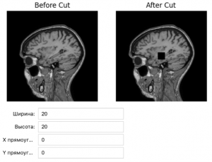 В Самарском политехе разработали платформу для генерации синтетических МРТ-снимков