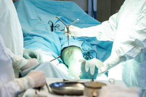 В Клиниках СамГМУ прооперировали пациента с хроническим остеомиелитом голени с использованием АПК «Автоплан»