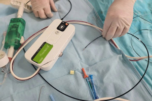 В Клиниках СамГМУ за прошедший год 135 пациентов спасли от ампутации нижних конечностей